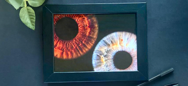 Фото одной радужки для двоих